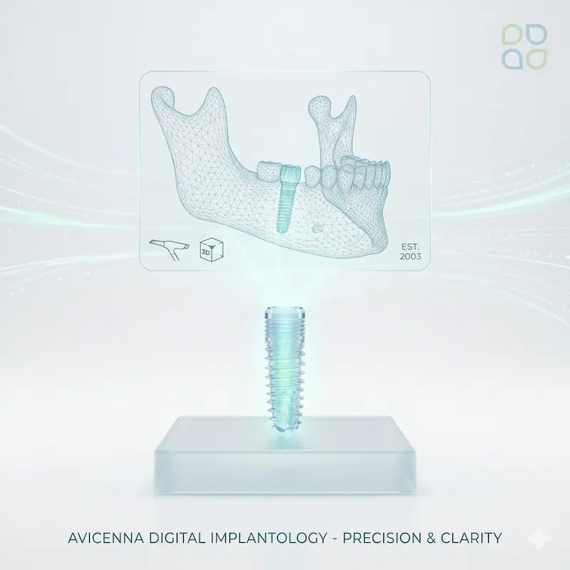 dijital implant teknolojisi