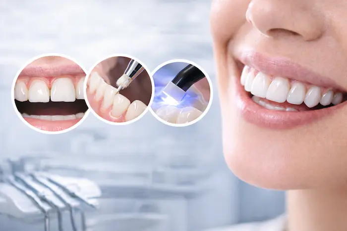 Estetik Diş Tedavileri