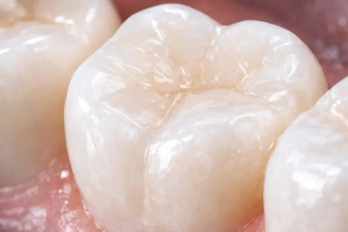 kompozit lamina bonding avicennadis