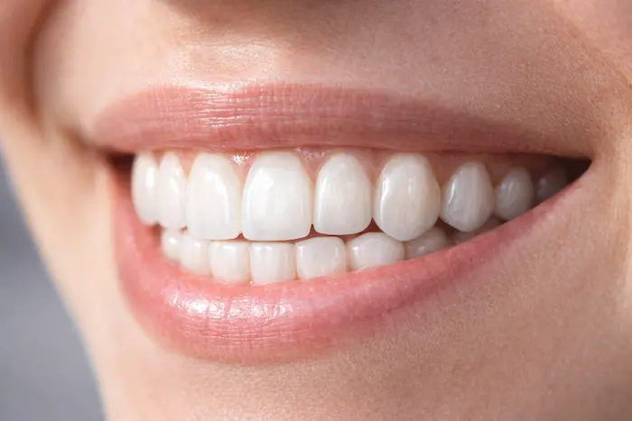 porselen zirkonyum gulus