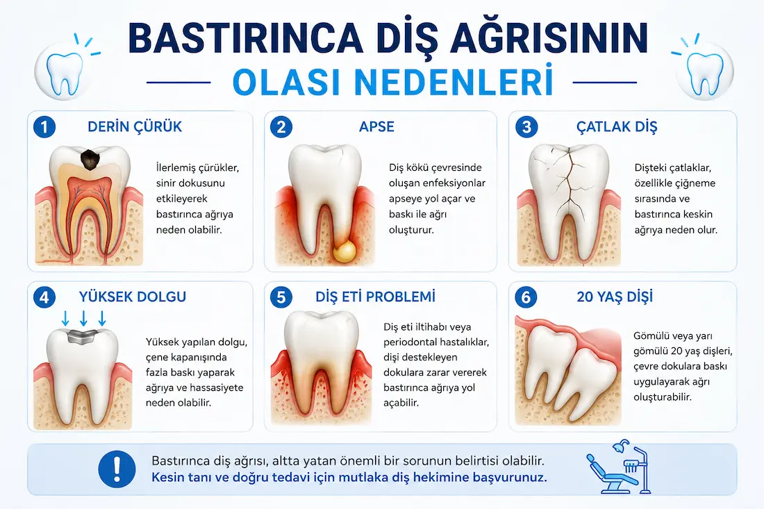 bastırınca diş ağrısının olası nedenleri